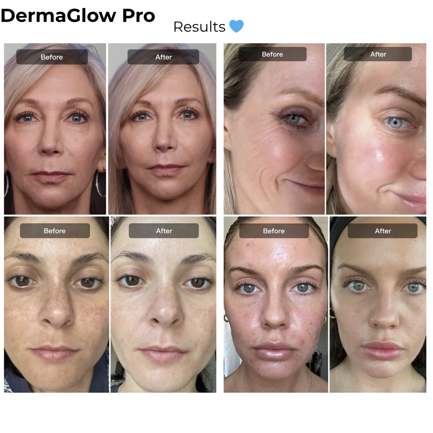 DermaGlow Pro